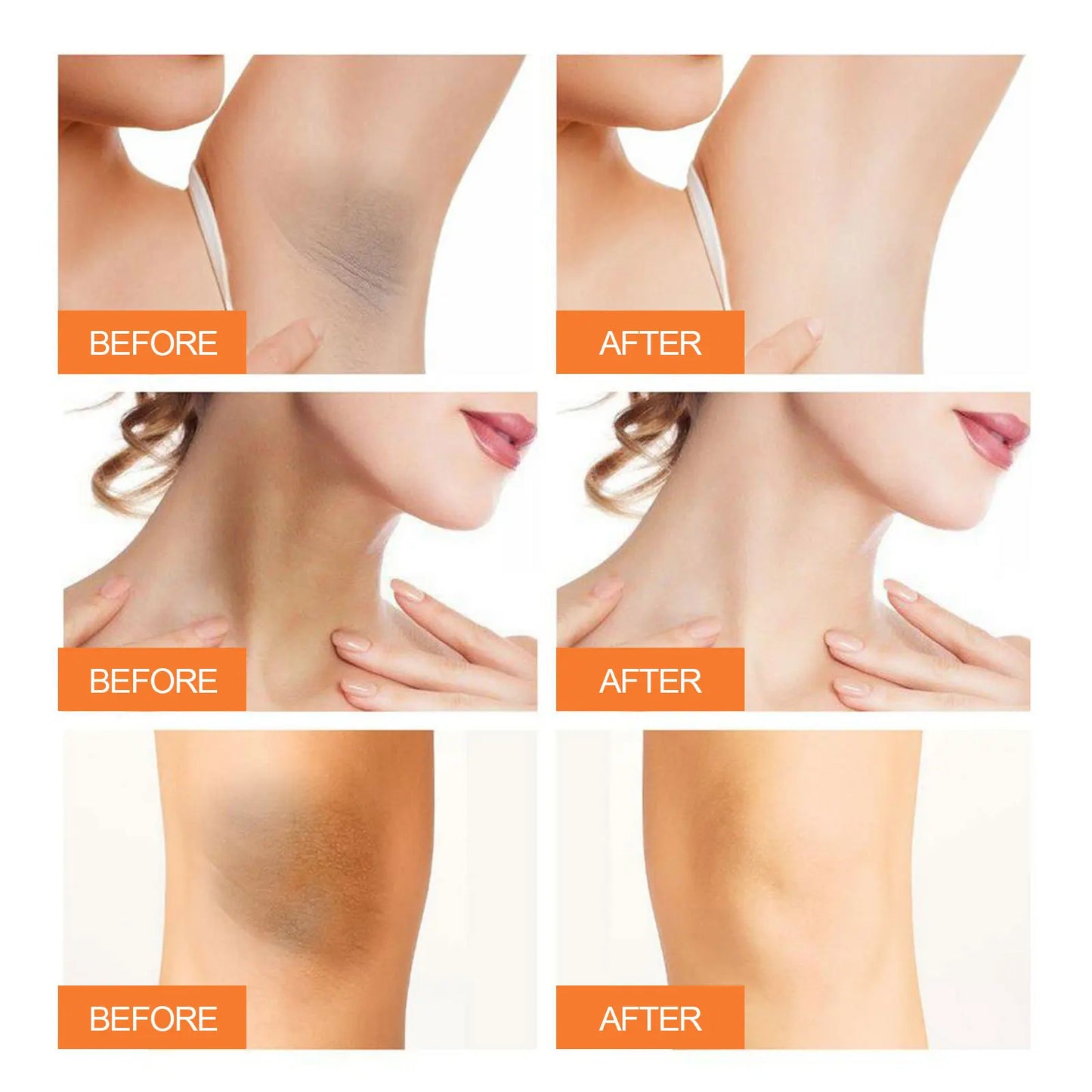Jaysuing Underarm Beauty Cream Fades Melanin And Dark Spots