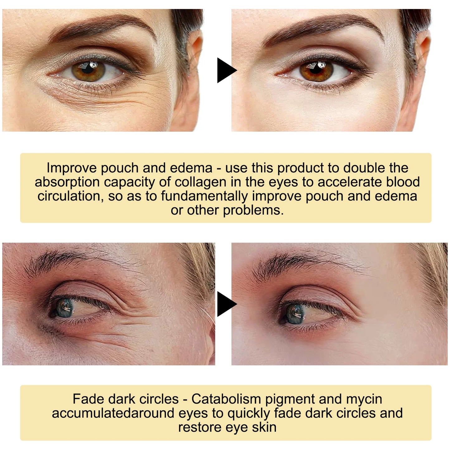 Eelhoe 24K Gold Under Eye Patches Anti Aging Moisturizing